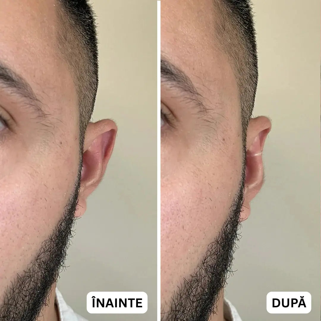 Corector Urechi Instant