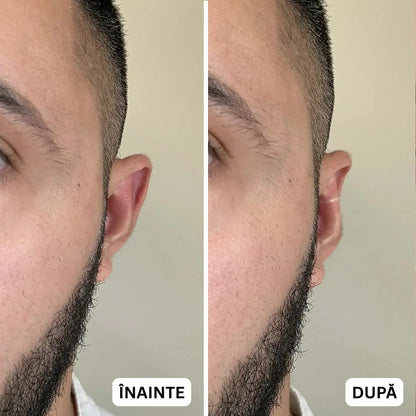 Corector Urechi Instant